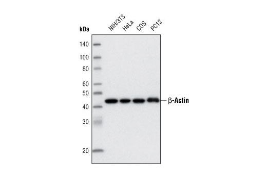 Western Blotting Image 1: β-Actin (13E5) Rabbit mAb (Biotinylated)