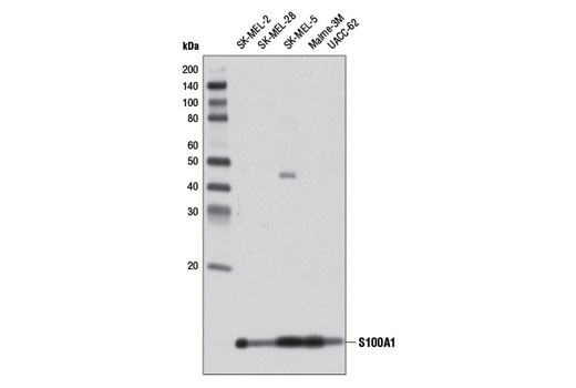 Western Blotting Image 1: S100A1 Antibody
