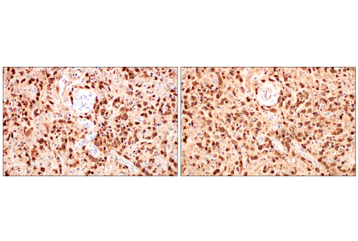 Immunohistochemistry Image 8: SERPINB9 (E9J8J) XP® Rabbit mAb (BSA and Azide Free)