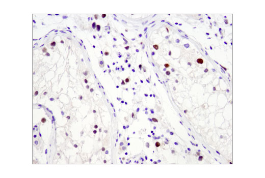 Immunohistochemistry Image 2: N-Myc (D4B2Y) Rabbit mAb (BSA and Azide Free)