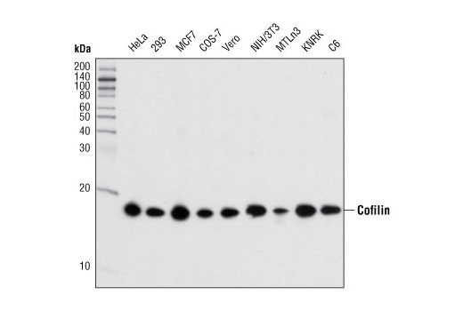  Image 9: Cofilin Activation Antibody Sampler Kit