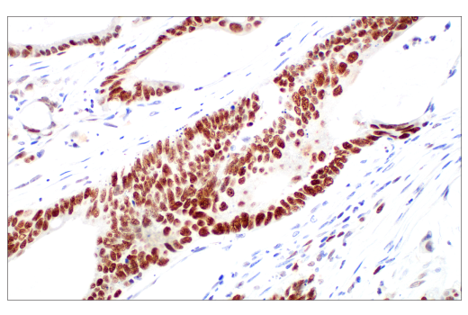  Image 3: PhosphoPlus® Ezh2 (Thr311) Antibody Duet