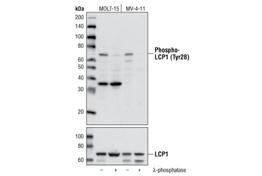 Western Blotting Image 1: Phospho-LCP1 (Tyr28) Antibody