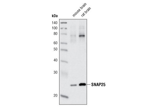  Image 5: Synaptic Vesicle Antibody Sampler Kit