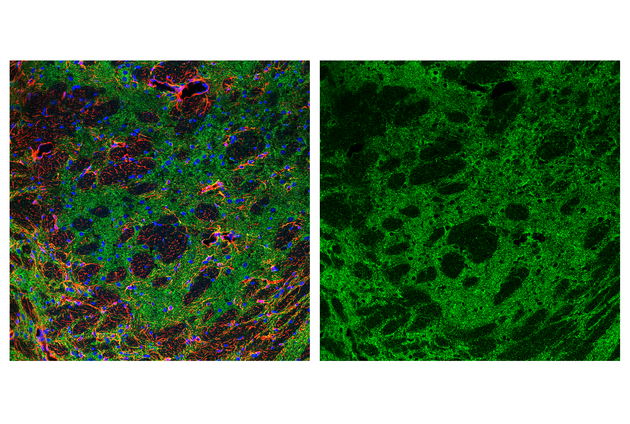 Immunofluorescence Image 4: AIF (D39D2) XP® Rabbit mAb
