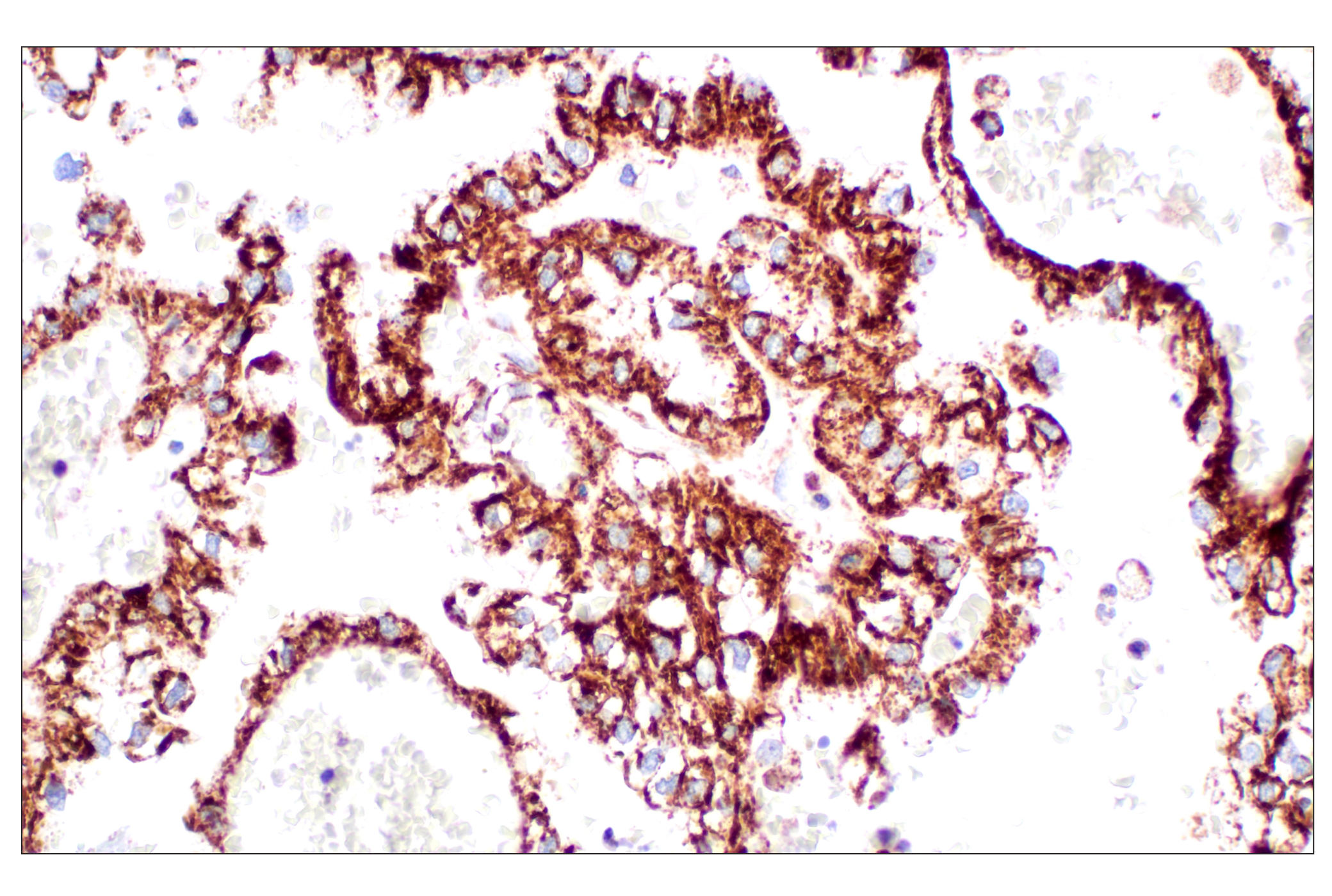  Image 24: Organelle Localization IF Antibody Sampler Kit