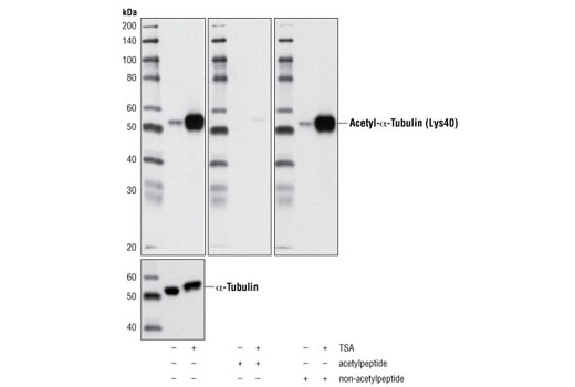 Western Blotting Image 1: Acetyl-α-Tubulin (Lys40) (D20G3) XP® Rabbit mAb
