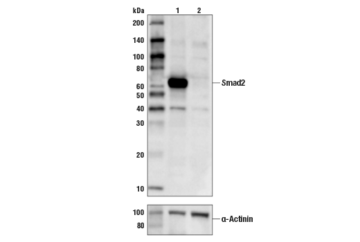  Image 2: PhosphoPlus® SMAD2 (Ser465/467) Antibody Duet