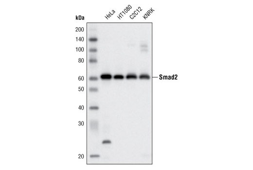  Image 4: PhosphoPlus® SMAD2 (Ser465/467) Antibody Duet