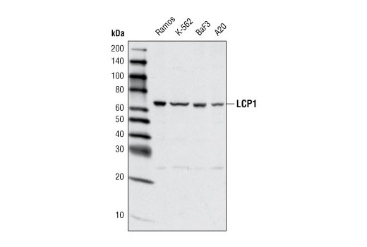 Western Blotting Image 1: LCP1 Antibody