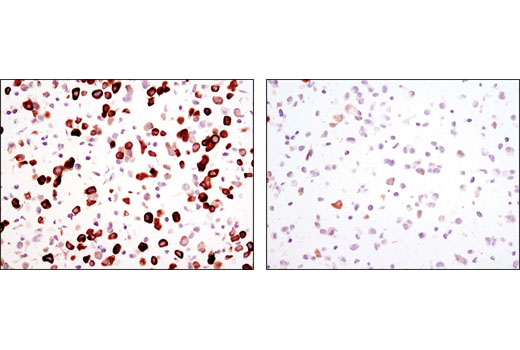 Immunohistochemistry Image 6: Phospho-S6 Ribosomal Protein (Ser240/244) (D68F8) XP® Rabbit mAb (BSA and Azide Free)