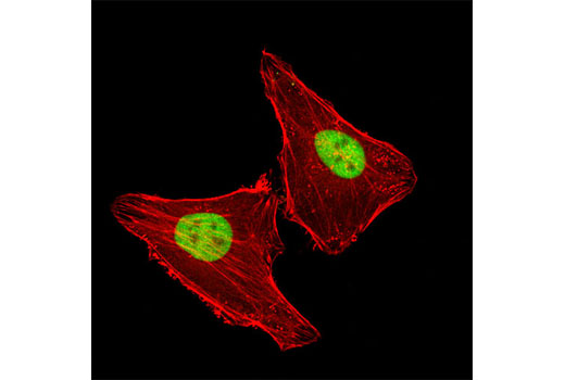 Immunofluorescence Image 1: LAP2α (3A3) Mouse mAb