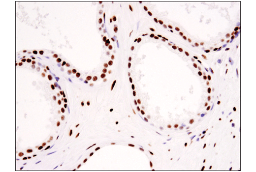 Immunohistochemistry Image 5: Tri-Methyl-Histone H3 (Lys36) (D5A7) XP® Rabbit mAb (BSA and Azide Free)
