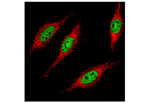 Immunofluorescence Image 1: Tri-Methyl-Histone H3 (Lys36) (D5A7) XP® Rabbit mAb (BSA and Azide Free)