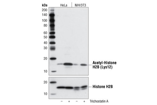Western Blotting Image 1: Acetyl-Histone H2B (Lys12) Antibody