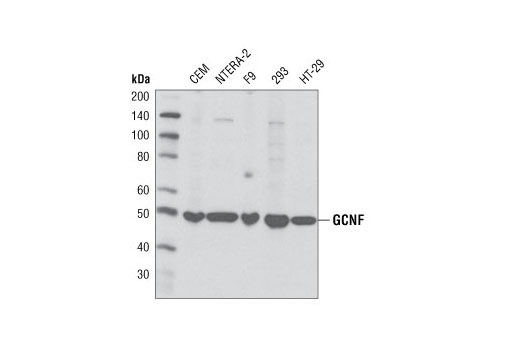 Western Blotting Image 1: GCNF Antibody