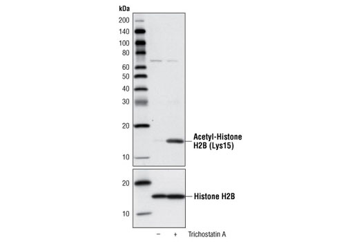 Western Blotting Image 1: Acetyl-Histone H2B (Lys15) Antibody