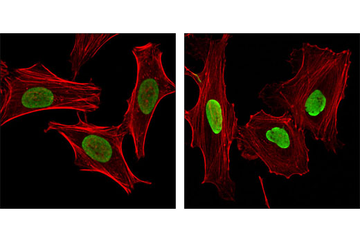 Immunofluorescence Image 1: Acetyl-Histone H2B (Lys15) Antibody