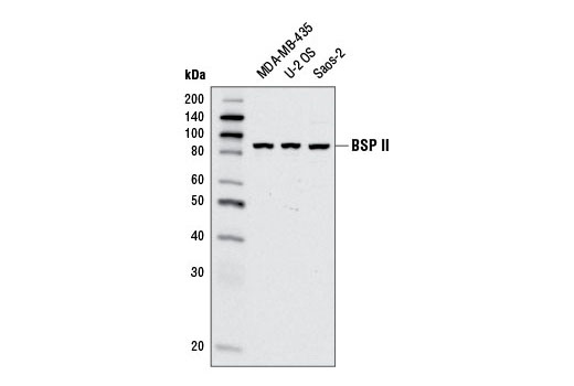 Western Blotting Image 1: BSP II Antibody