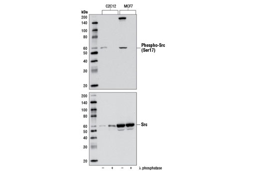 Western Blotting Image 1: Phospho-Src (Ser17) Antibody