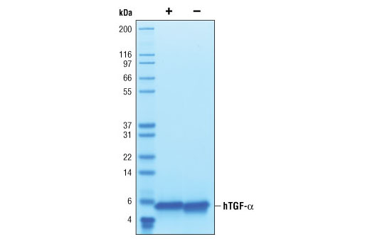  Image 2: Human Transforming Growth Factor α (hTGF-α)