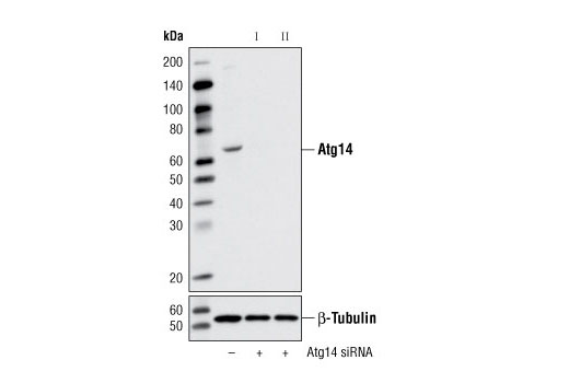 Western Blotting Image 1: Atg14 Antibody