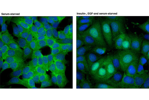 Immunofluorescence Image 2: RSK2 (D21B2) XP® Rabbit mAb