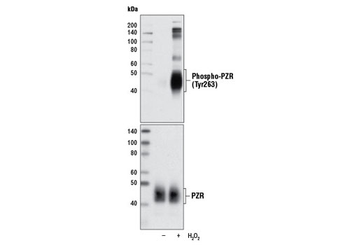 Western Blotting Image 1: Phospho-PZR (Tyr263) Antibody