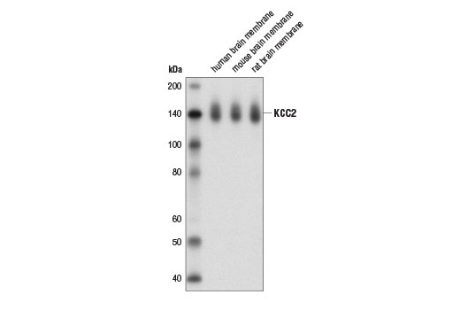 Western Blotting Image 1: KCC2 Antibody