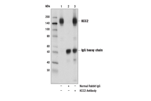 Immunoprecipitation Image 1: KCC2 Antibody