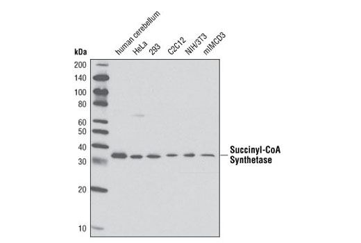 Western Blotting Image 1: Succinyl-CoA Synthetase Antibody