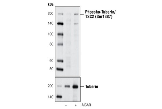 Western Blotting Image 1: Phospho-Tuberin/TSC2 (Ser1387) Antibody