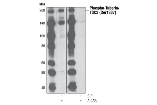 Western Blotting Image 2: Phospho-Tuberin/TSC2 (Ser1387) Antibody
