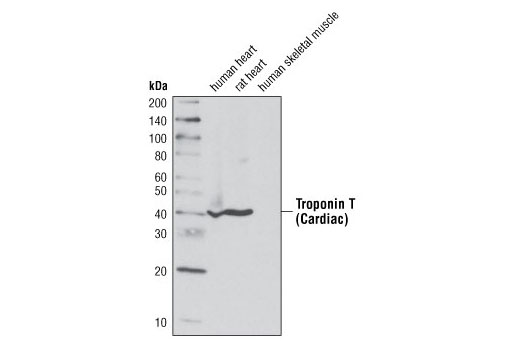  Image 12: Cardiogenesis Marker Antibody Sampler Kit