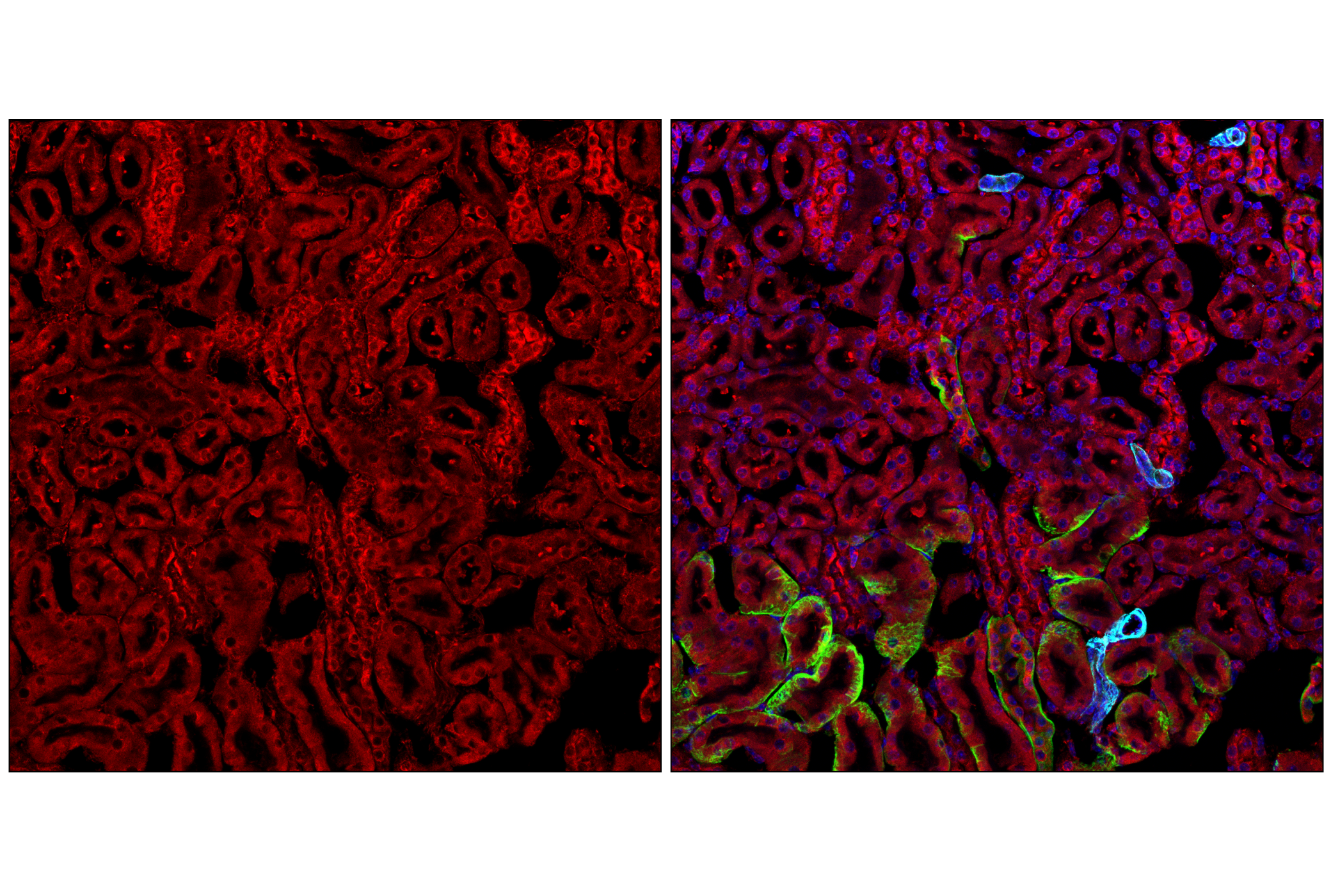 Immunofluorescence Image 2: S6 Ribosomal Protein (54D2) Mouse mAb (Alexa Fluor® 700 Conjugate)