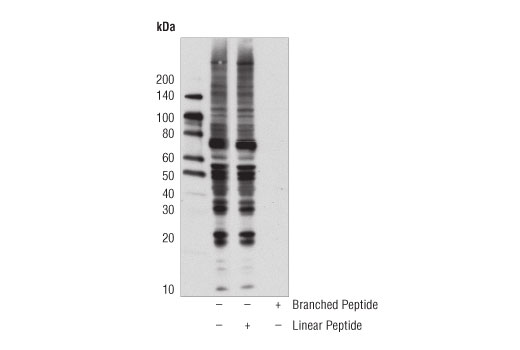 Western Blotting Image 5: K63-linkage Specific Polyubiquitin (D7A11) Rabbit mAb