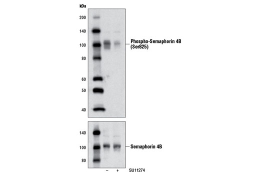 Western Blotting Image 1: Phospho-Semaphorin 4B (Ser825) Antibody