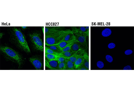 Immunofluorescence Image 3: Keratin 17/19 (D4G2) XP® Rabbit mAb (BSA and Azide Free)