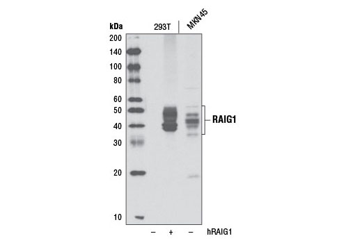 Western Blotting Image 1: RAIG1 Antibody