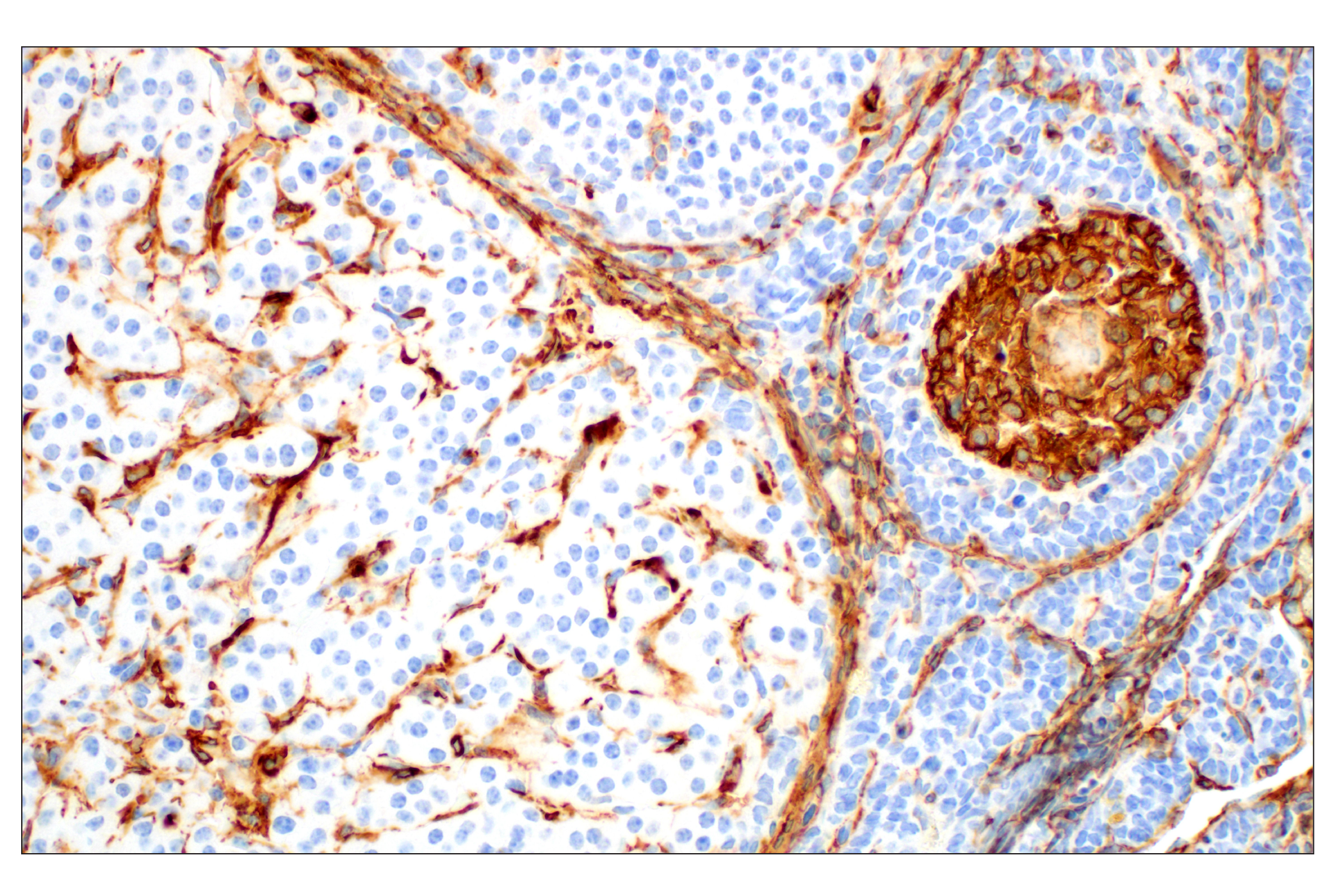Immunohistochemistry Image 6: α-Smooth Muscle Actin (1A4) Mouse mAb (IHC Formulated)