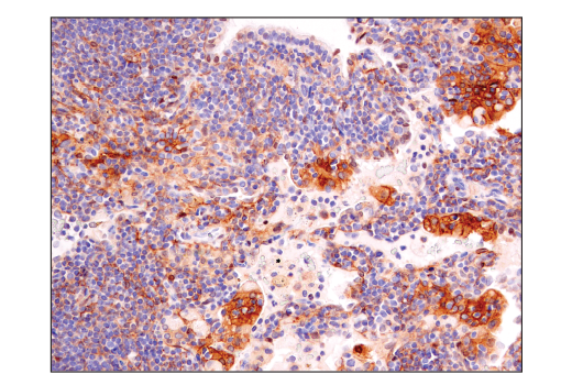 Immunohistochemistry Image 7: Notch2 (D76A6) XP® Rabbit mAb