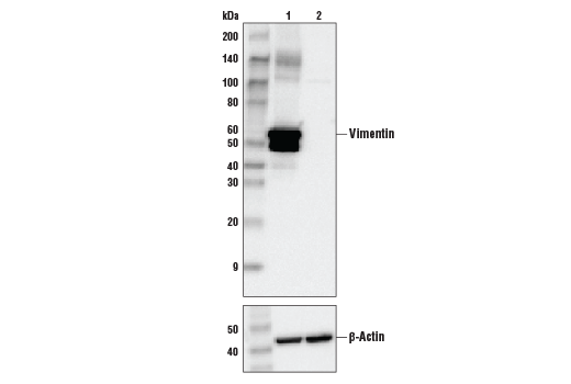  Image 11: Vimentin Antibody Sampler Kit