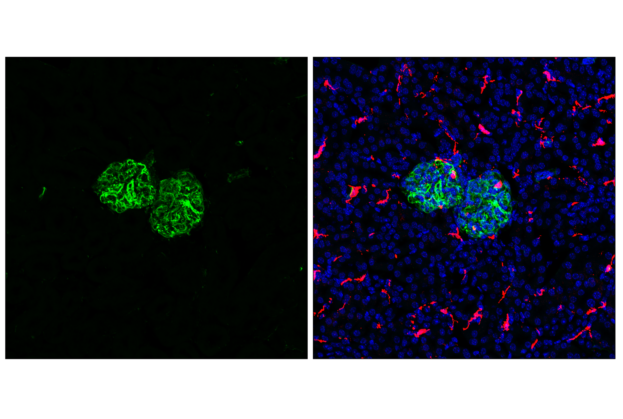 Immunofluorescence Image 1: Vimentin (D21H3) XP® Rabbit mAb