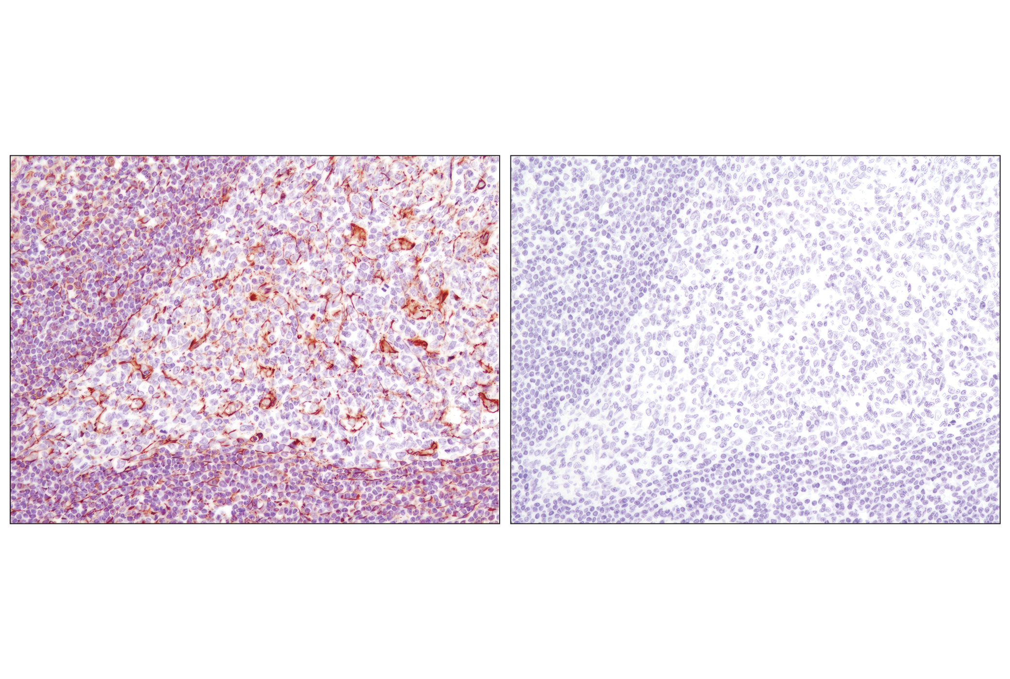  Image 48: Cytoskeletal Marker Antibody Sampler Kit
