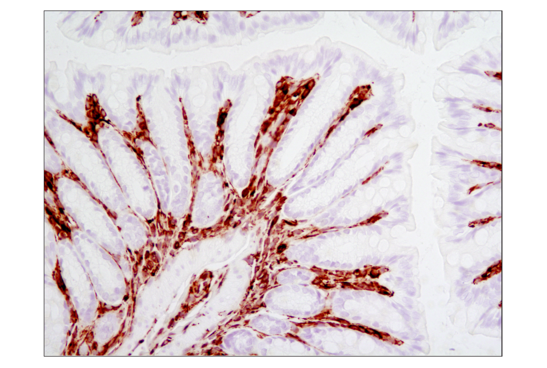  Image 37: Cytoskeletal Marker Antibody Sampler Kit