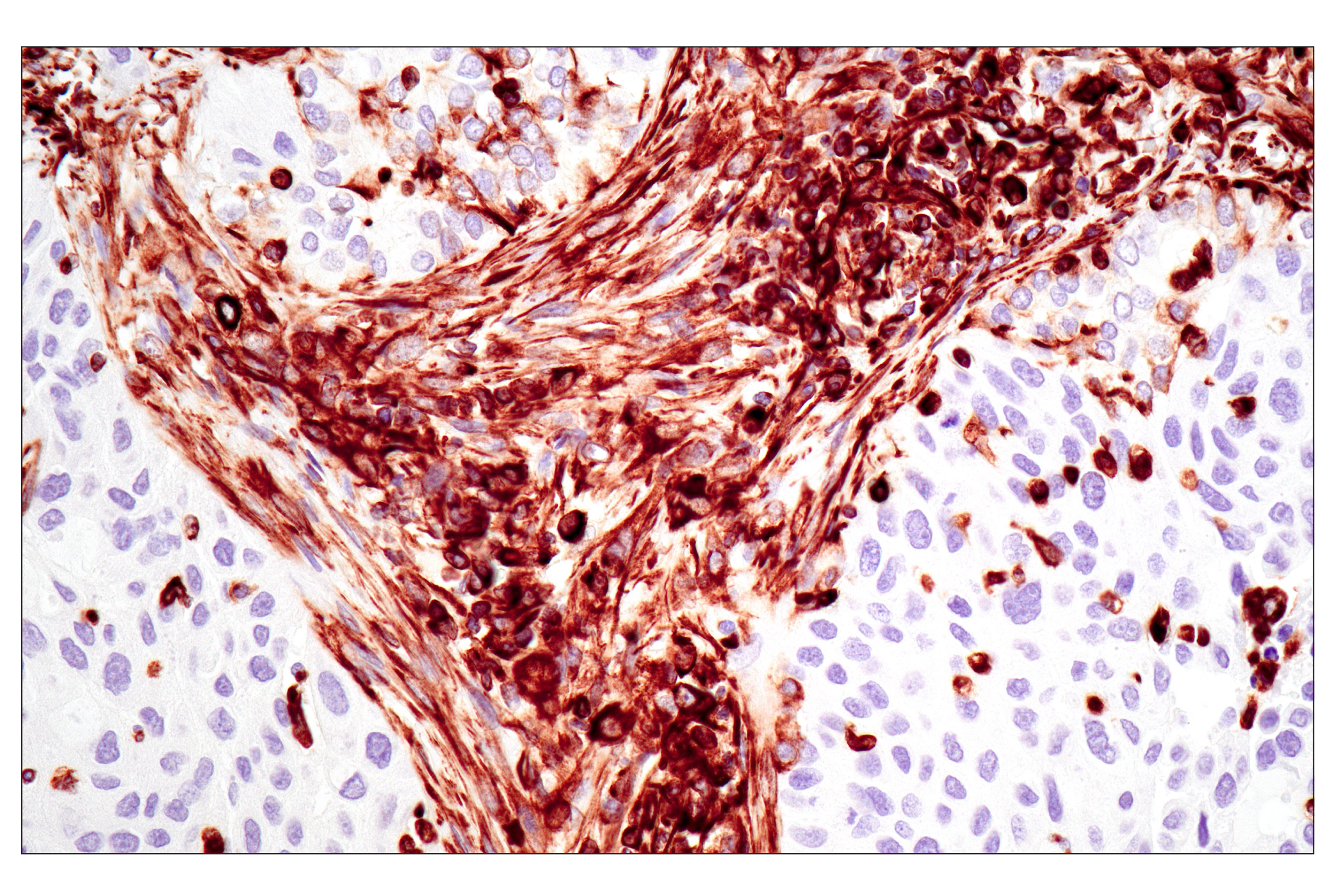  Image 23: Cytoskeletal Marker Antibody Sampler Kit