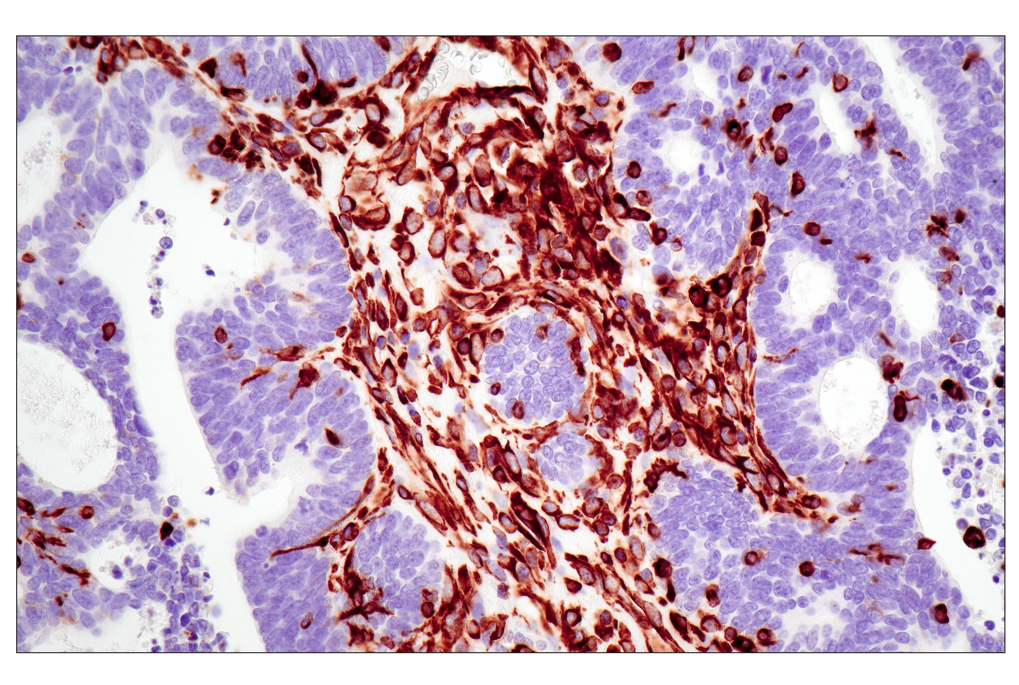  Image 28: Cytoskeletal Marker Antibody Sampler Kit