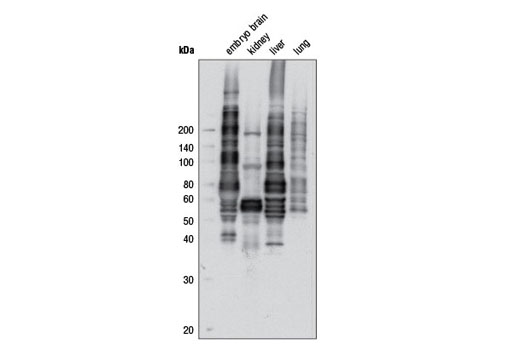  Image 1: Phospho-(Ser/Thr) Kinase Substrate Antibody Sampler Kit