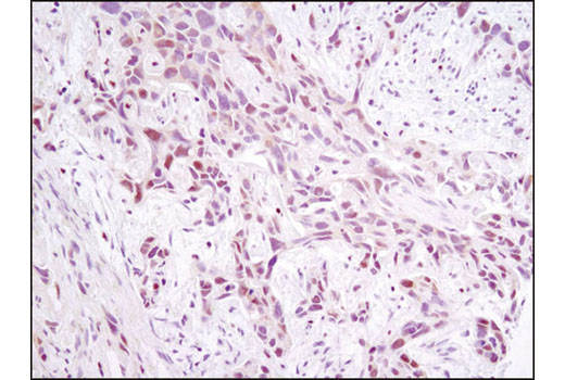 Immunohistochemistry Image 1: NFAT1 (D43B1) XP® Rabbit mAb