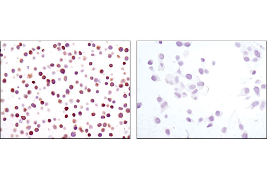 Immunohistochemistry Image 4: NFAT1 (D43B1) XP® Rabbit mAb